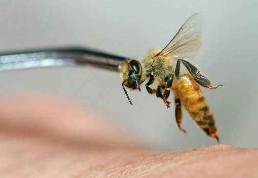 被蜜蜂蜇伤了该怎么办呢?